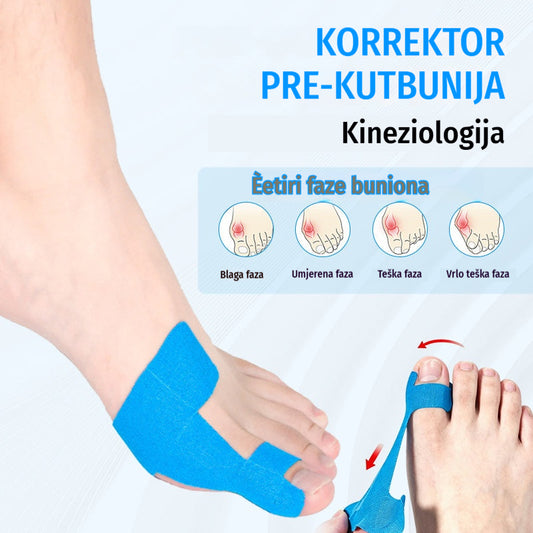 [50/100 komada] Elastični zavoji za prste, zavoji za opekline, izdržljivi sportski zavoji