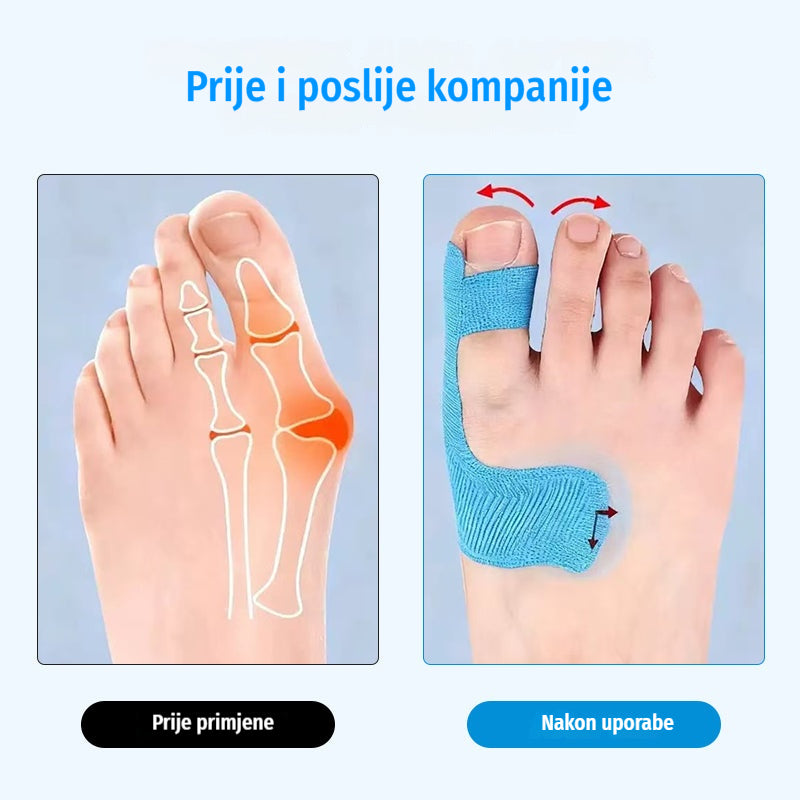 [50/100 komada] Elastični zavoji za prste, zavoji za opekline, izdržljivi sportski zavoji